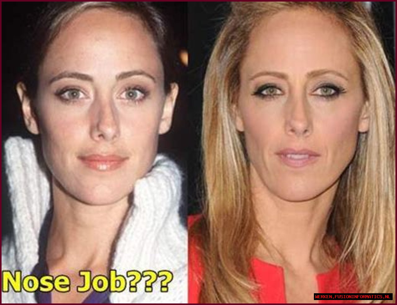 Kim Raver Plastic Surgery Before and After