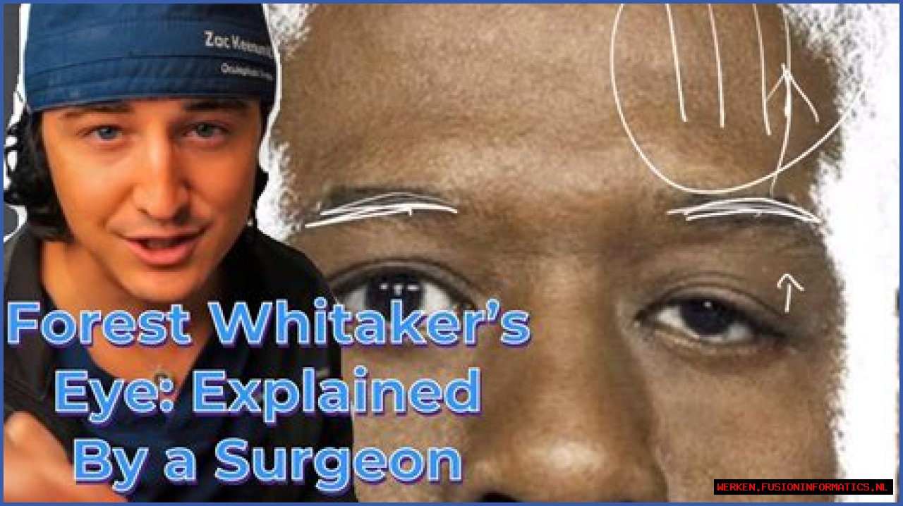 Unveiling Forest Whitaker's Eye Condition: Discoveries And Insights